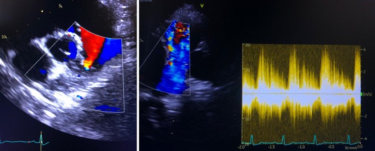 2020_06_18_13_50_02_Foto