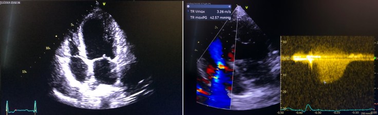 WhatsApp Image 2020-06-18 at 11.43.55