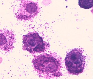 Mastociti il cui citoplasma è colmo di granuli. Sono presenti granuli liberi anche sullo sfondo