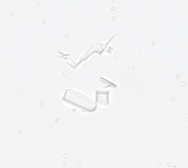 cristalli al sedimento urinario