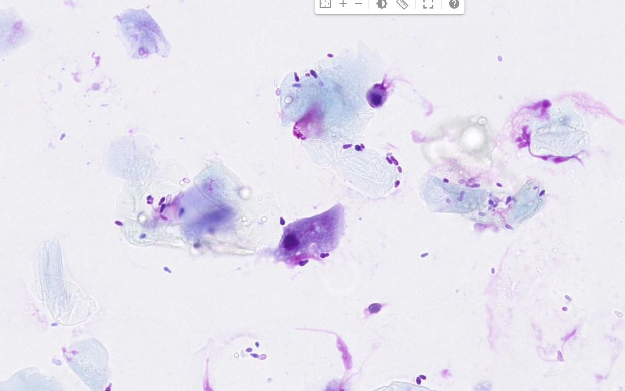 malassezia citologia auricolare