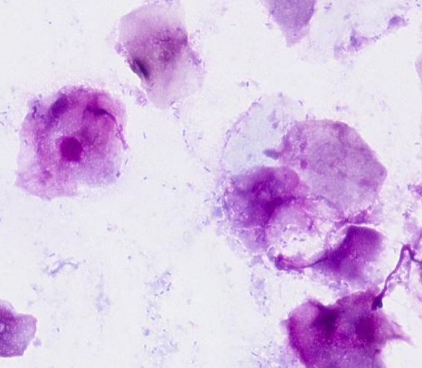 batteri coccoidi alla citologia cutanea